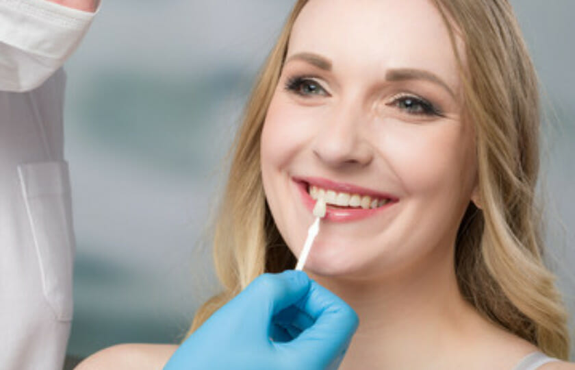 dental veneers Centreville