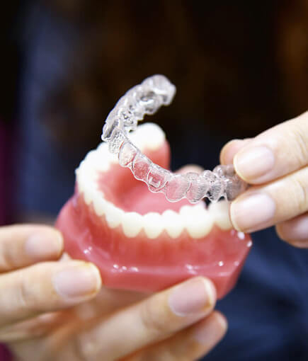 img-What-Is-Invisalign