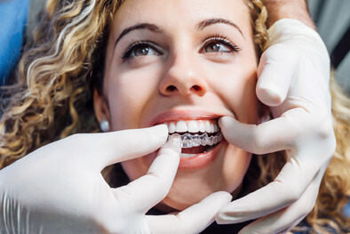 img-Why-Choose-Invisalign-Over-Other-Options